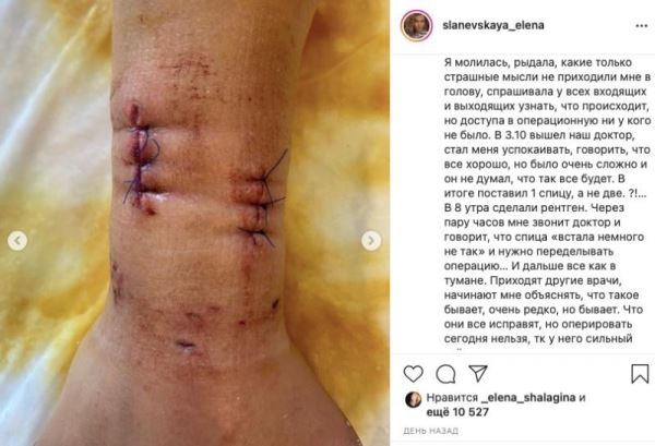 "Не врач, а мясник!": племянник певицы Славы едва не лишился руки в больнице